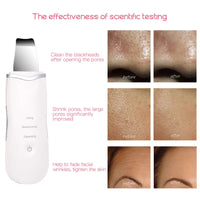 3-in-1 Ultrasonic Facial Skin Scrubber and Pore Cleaner