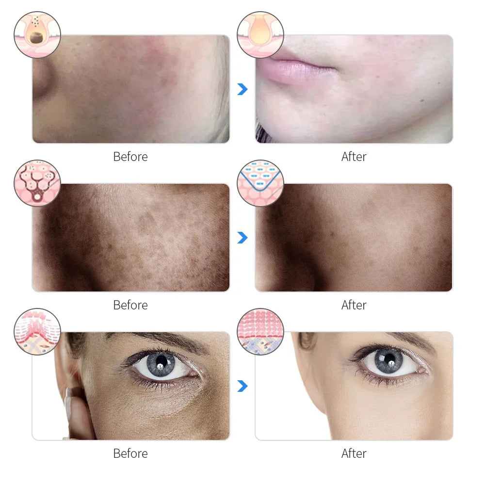 7-Color LED Photon Light Therapy Facial Mask - 21