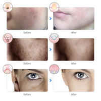 7-Color LED Photon Light Therapy Facial Mask