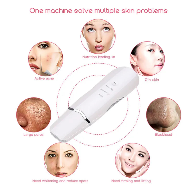 3-in-1 Ultrasonic Facial Skin Scrubber and Pore Cleaner - 10