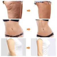 EMS Body Sculpting & Fat Burning Massage Device