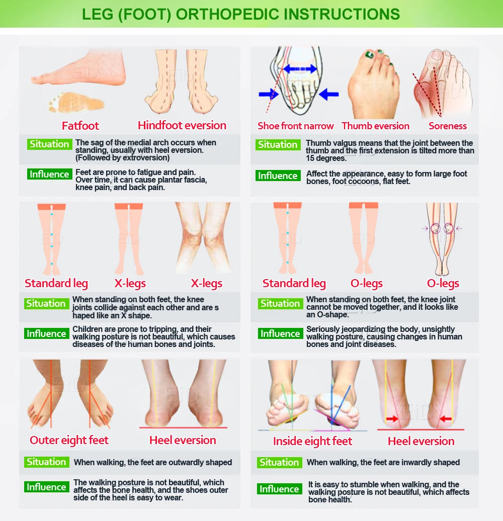 Orthopedic Silicone Bunion Corrector and Toe Straightener - 31