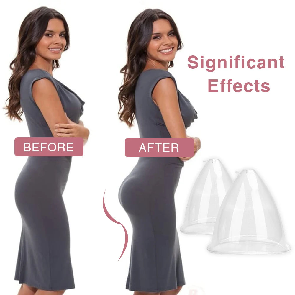 Vacuum Suction Cups for Breast and Buttock Lifting - 17