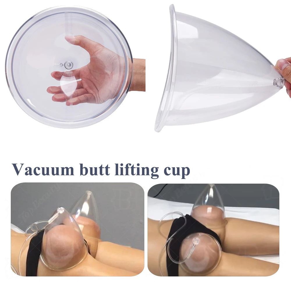 Vacuum Suction Cups for Breast and Buttock Lifting - 5