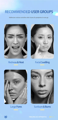 Cryo Facial Ice Roller for Puffy Skin and Pore Reduction