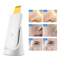 Ultrasonic Facial Skin Scrubber and Pore Deep Cleaning Device