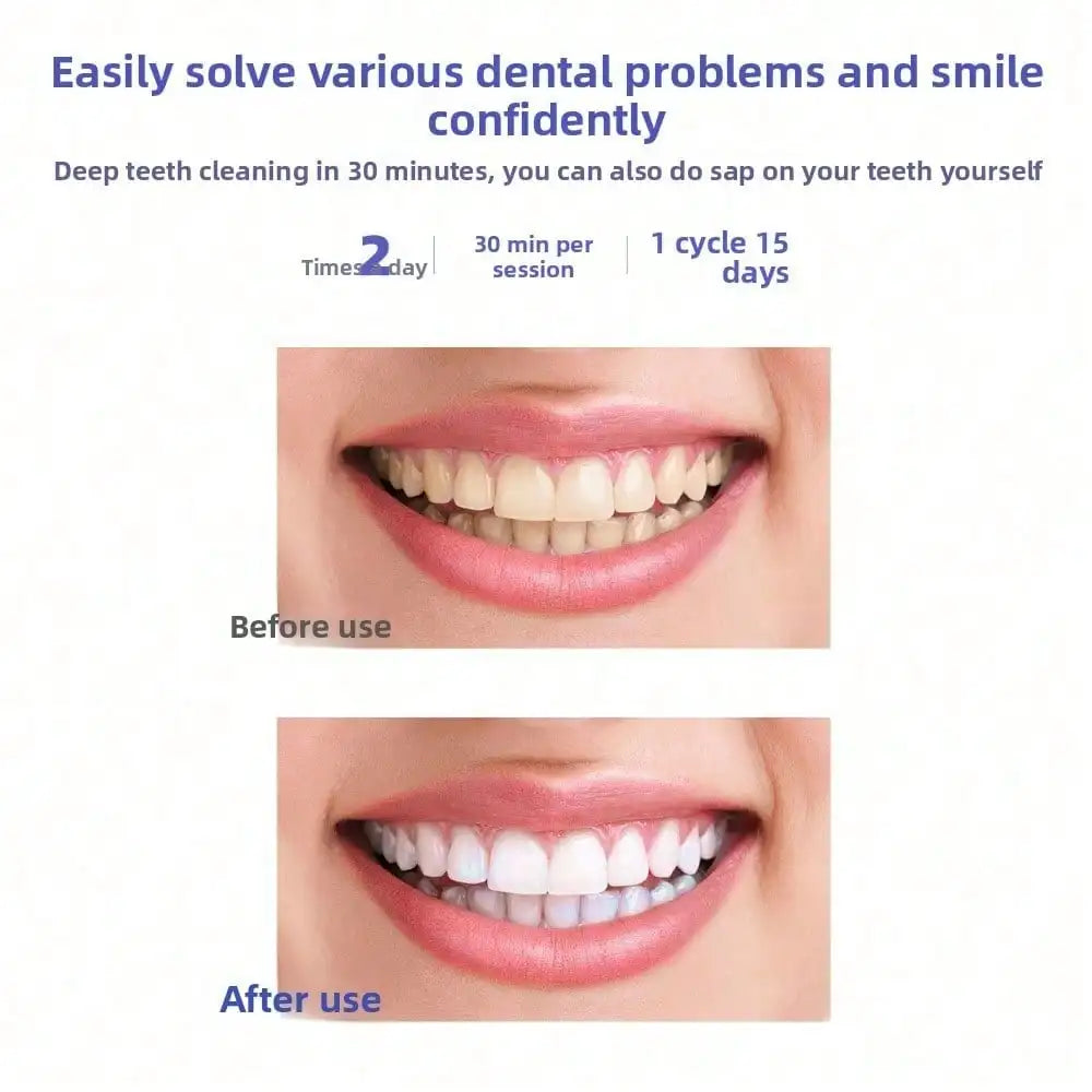 Wireless LED Teeth Whitening Kit for Home Use - 6