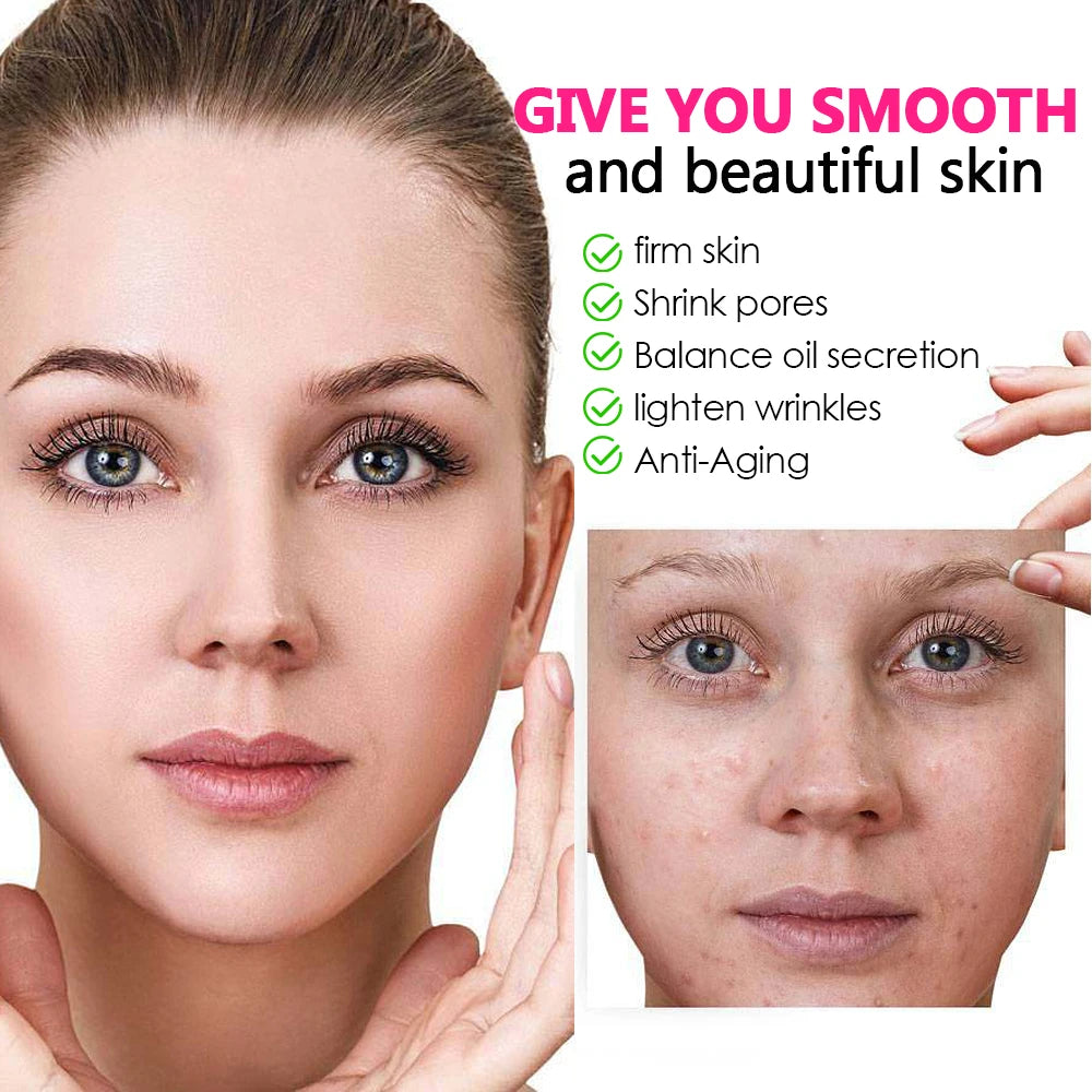 LED Photon Therapy Lamp for Acne and Skin Rejuvenation - 3