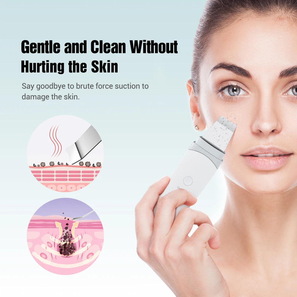 Ultrasonic Facial Skin Scrubber and Pore Cleaner - 32