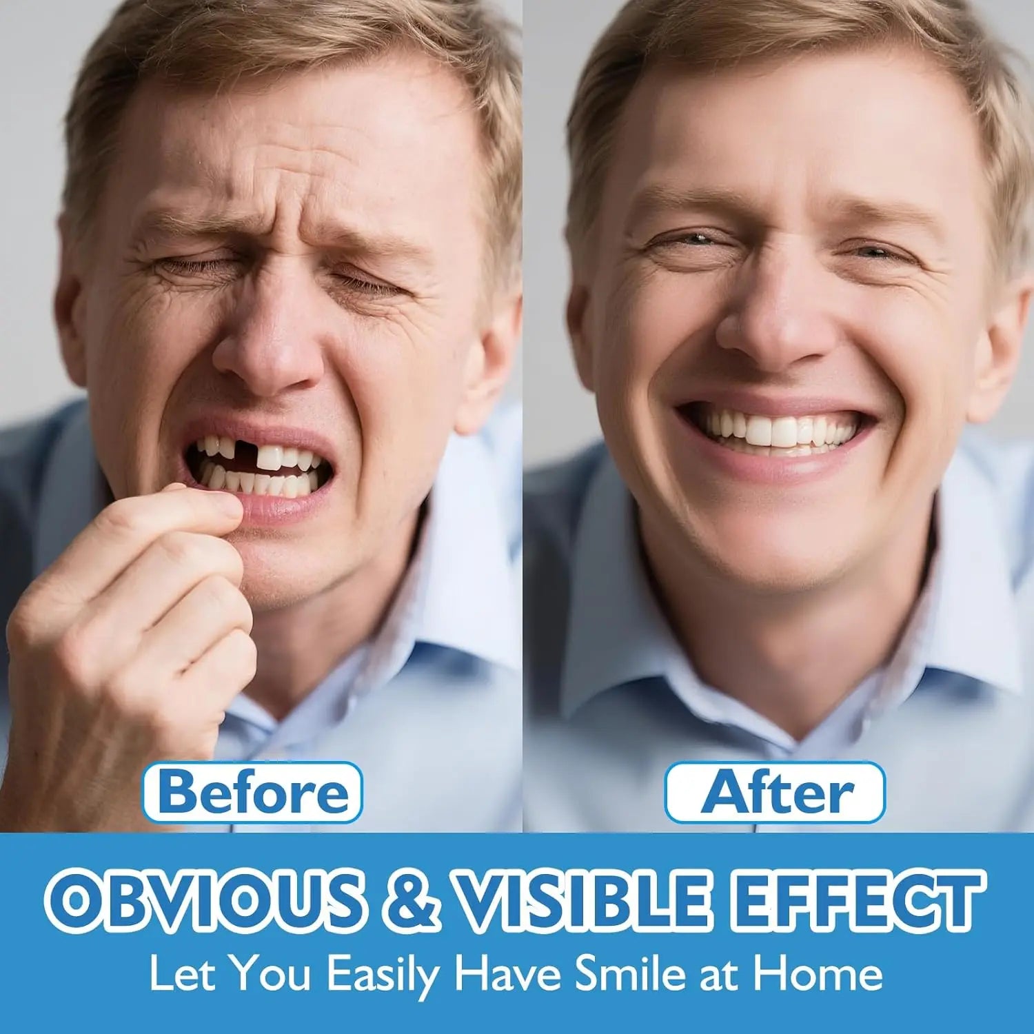 Comfort Fit Cosmetic Dentures for Instant Smile Confidence - 3