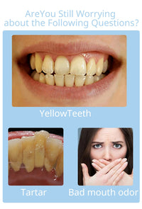 Portable LED Teeth Whitening System for Professional Results