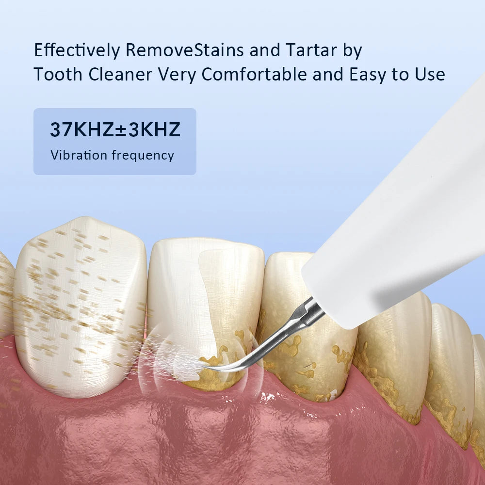 Electric Ultrasonic Teeth Tartar and Plaque Remover - 3