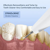 Electric Ultrasonic Teeth Tartar and Plaque Remover