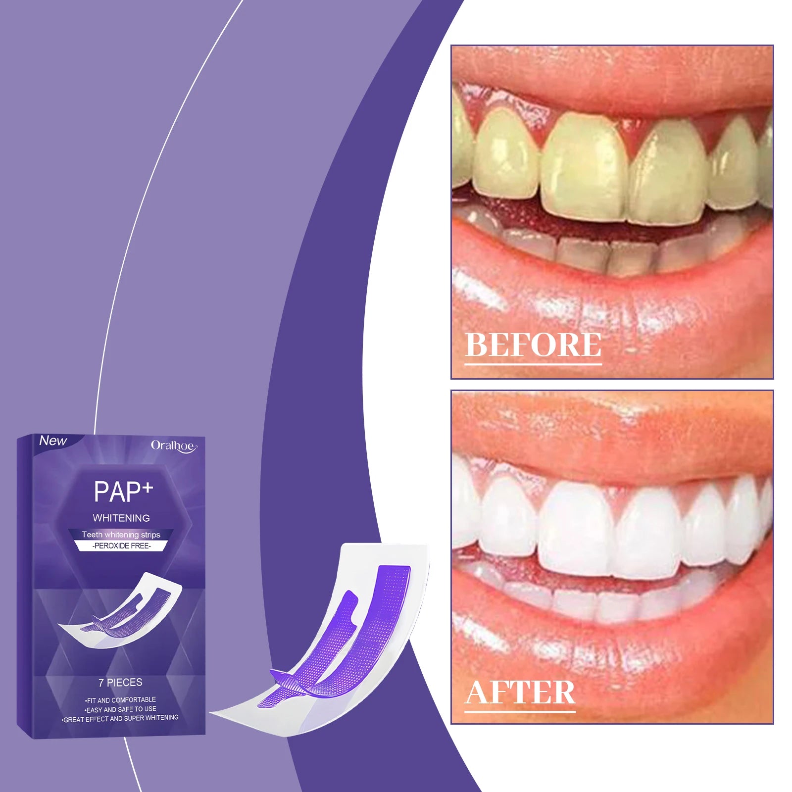 Purple Teeth Whitening Strips for Radiant Smile - 7