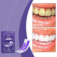 Purple Teeth Whitening Strips for Radiant Smile