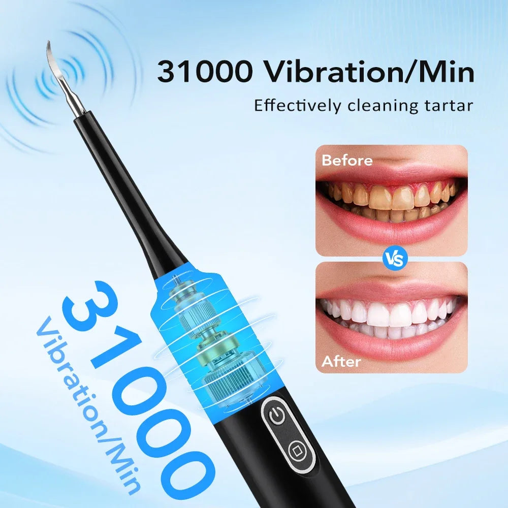 Sonic Electric Teeth Tartar and Plaque Remover - 3