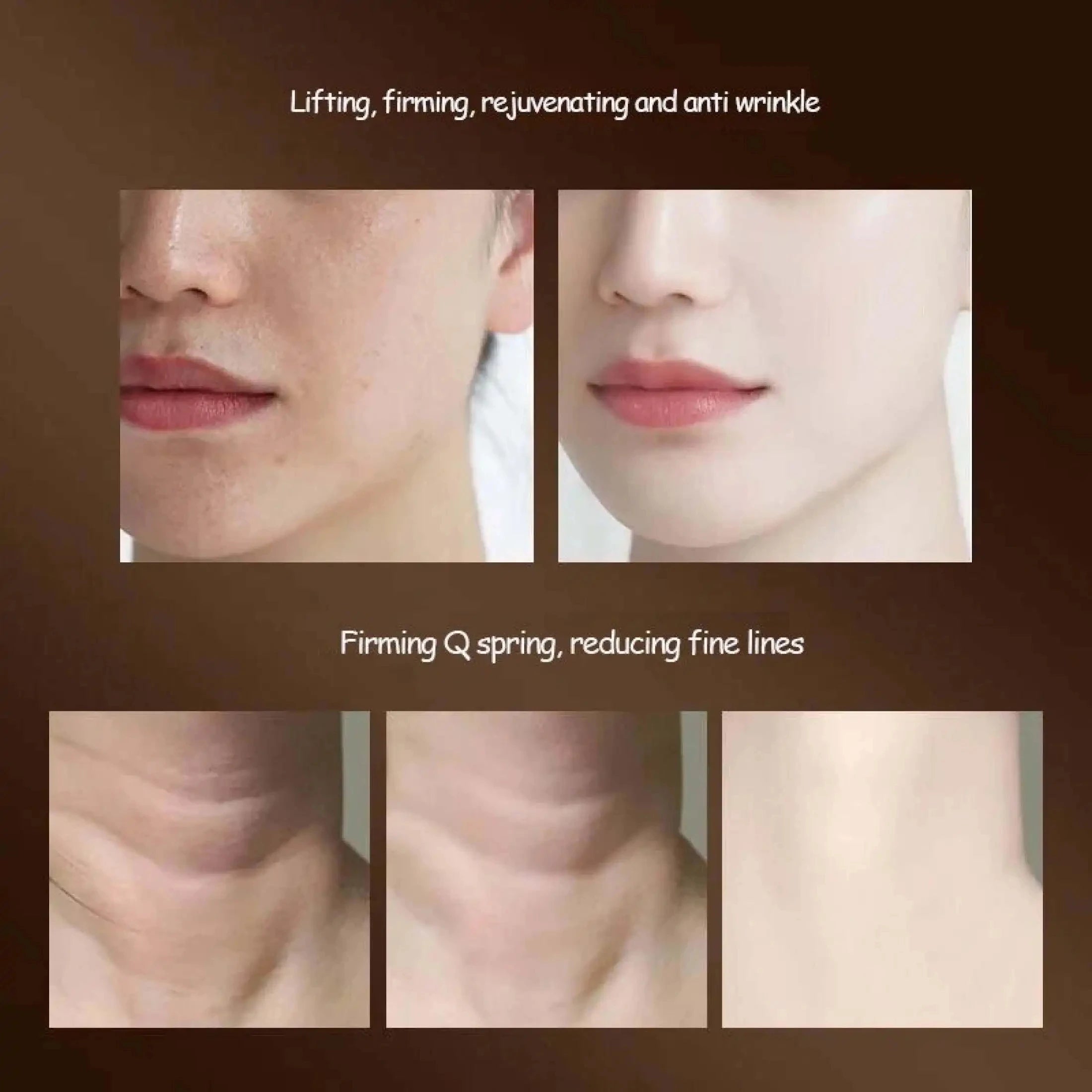 3-in-1 Facial & Neck Lifting Massager - 8