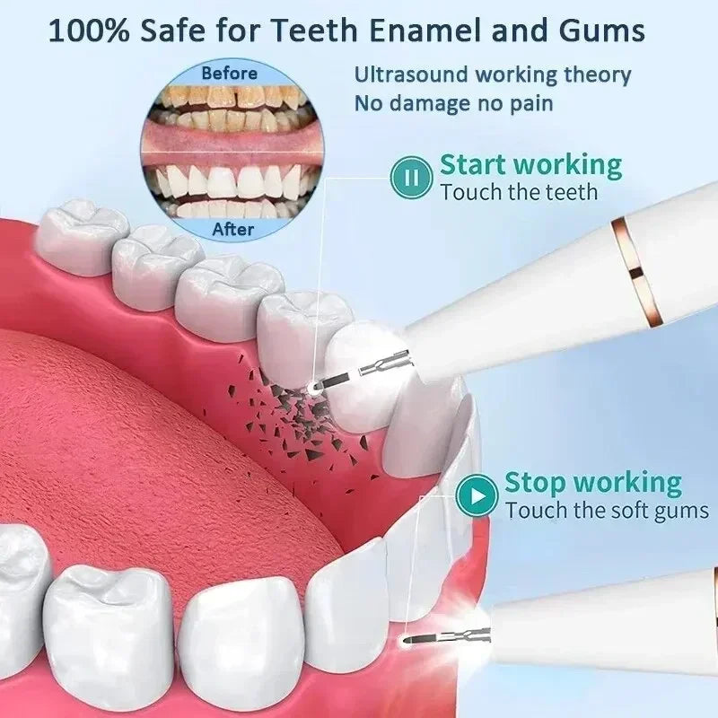 Electric Sonic Teeth Tartar Remover and Plaque Cleaner - 2