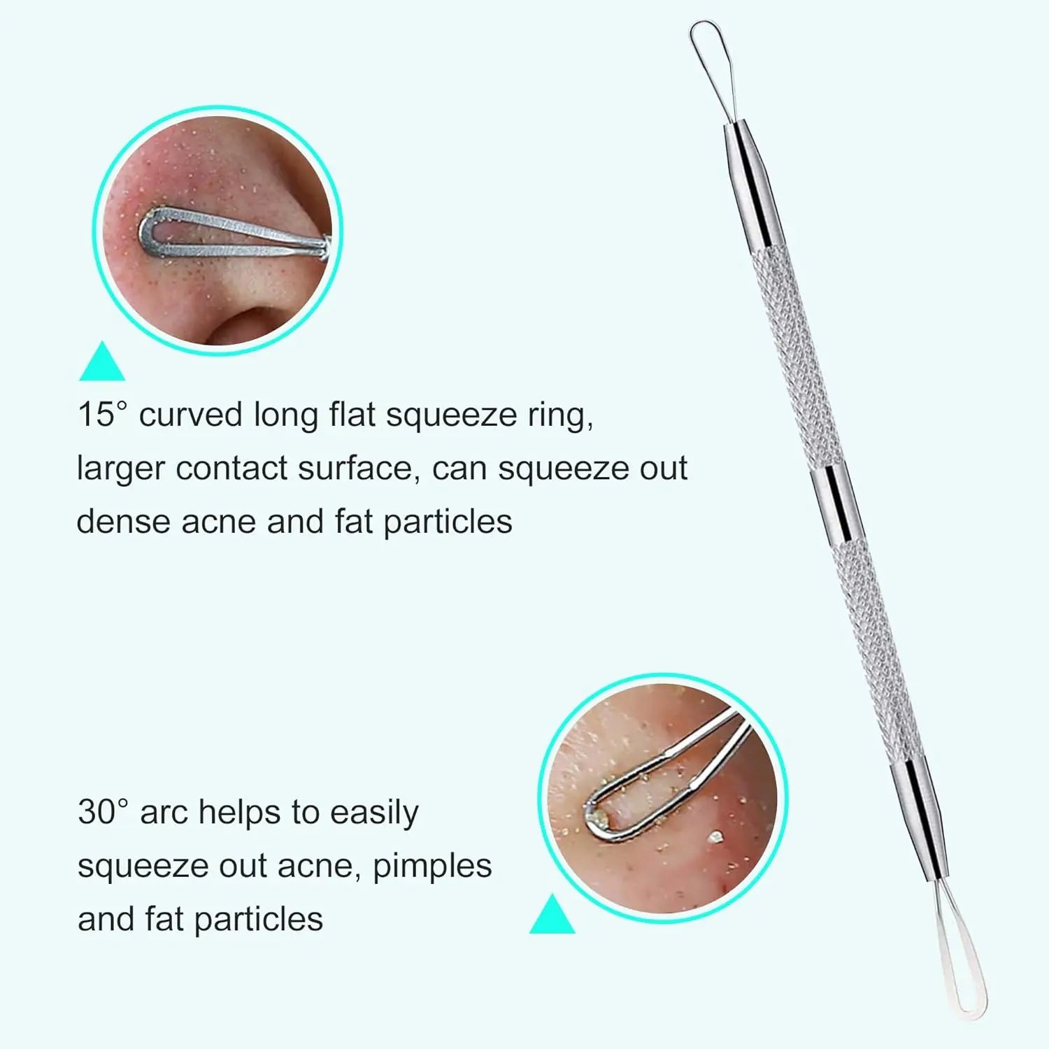 5-Piece Stainless Steel Blackhead and Acne Removal Kit - 5