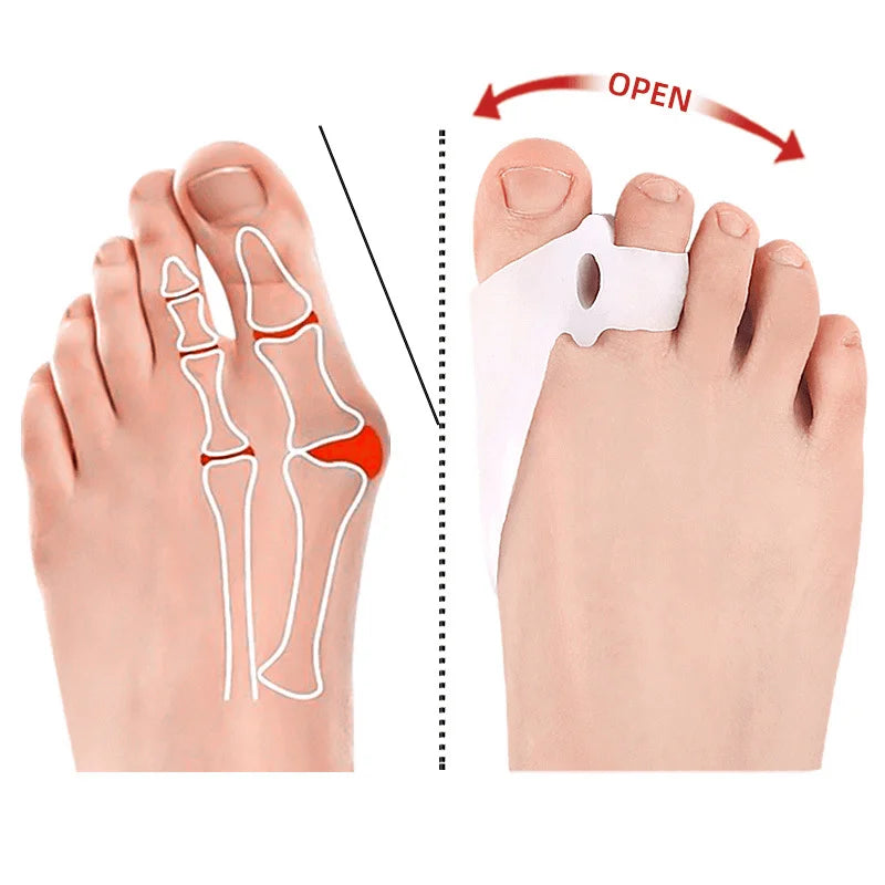 Soft Gel Bunion Corrector and Toe Straightener - 11