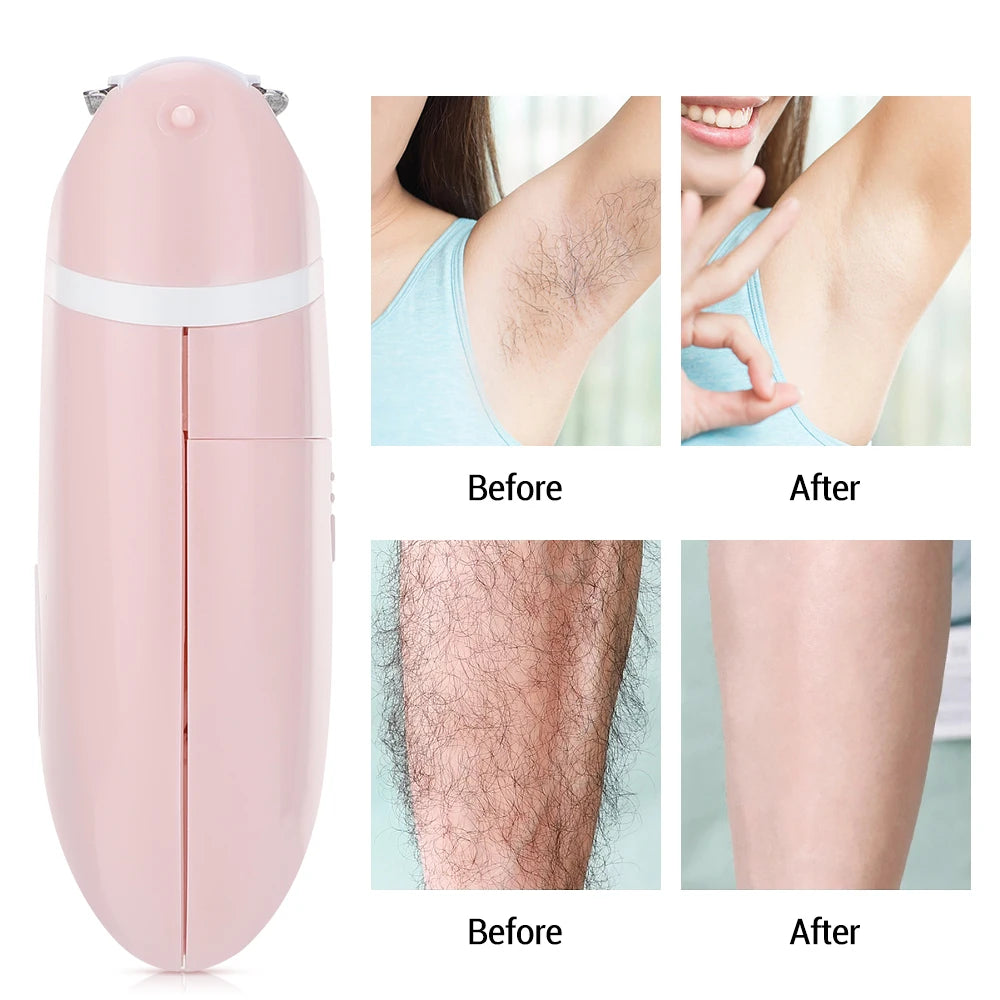 3-in-1 Electric Hair Removal Shaver for Women - 6