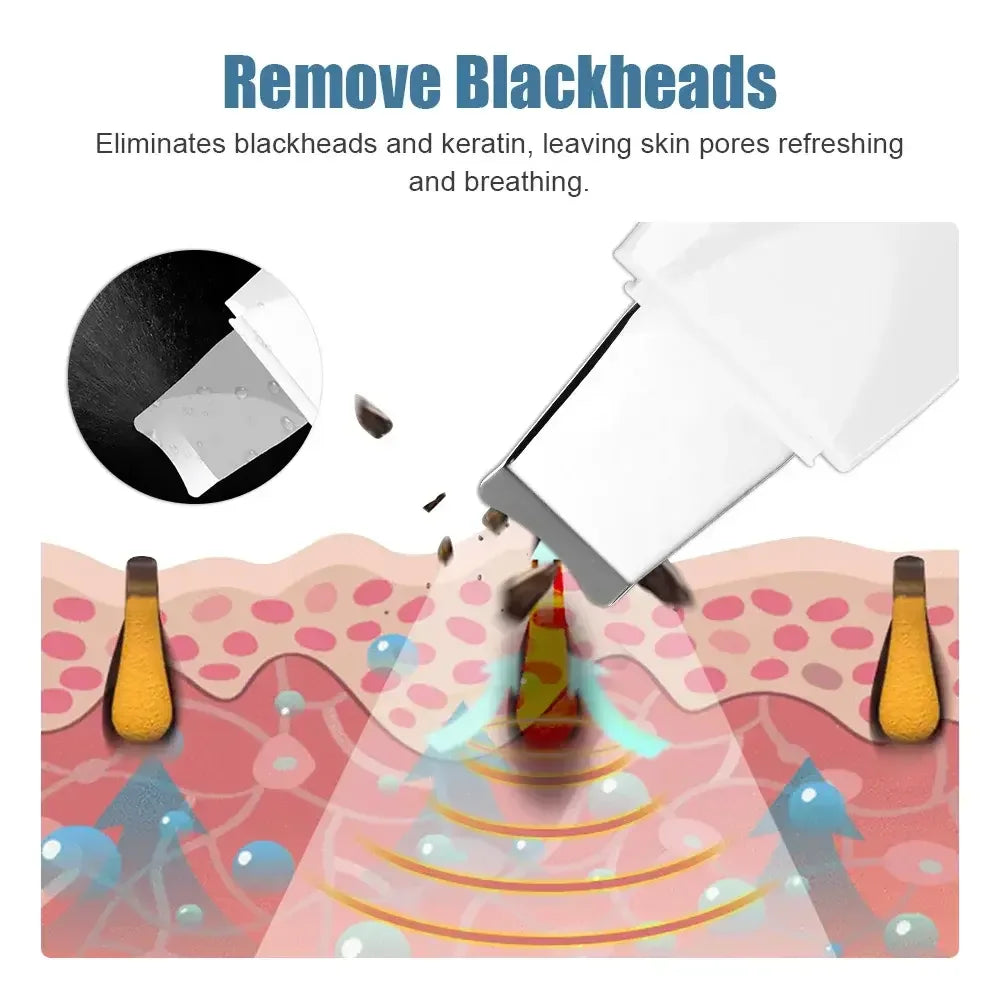 Ultrasonic Facial Skin Scrubber and Pore Cleaner - 6