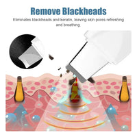 Ultrasonic Facial Skin Scrubber & Blackhead Remover