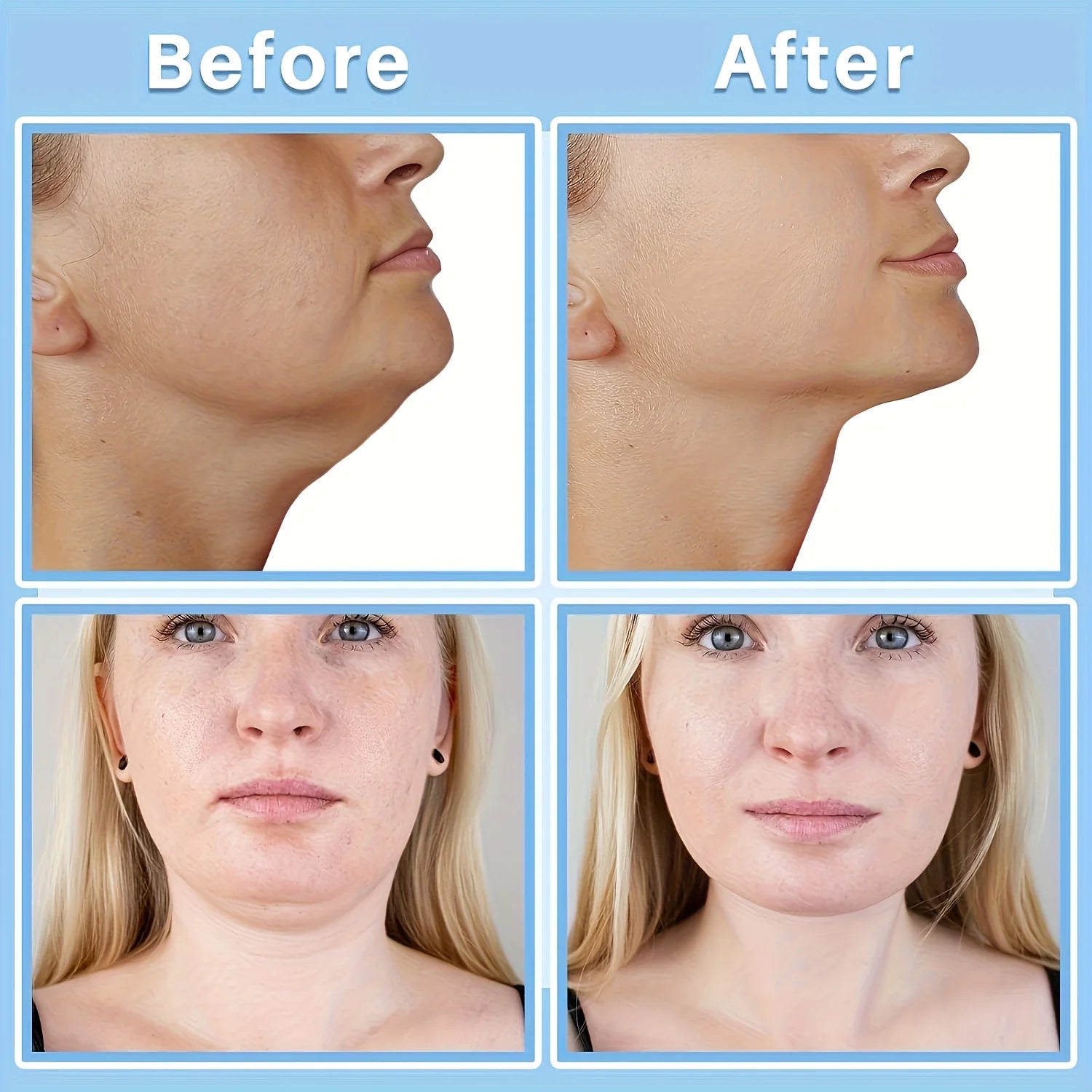 Invisible Neck Lifting and Tightening Patches - 4