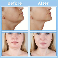 Invisible Neck Lifting and Tightening Patches