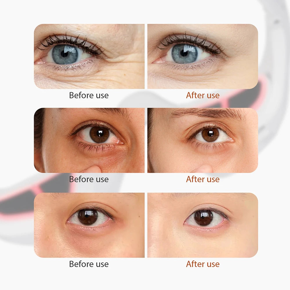 3D EMS Red Light Eye Massager for Fatigue and Wrinkles - 19