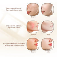7-Color Photon LED Face and Neck Rejuvenation Mask