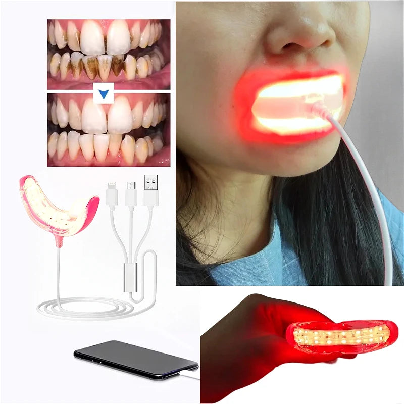 Portable Red Light Therapy Device for Oral Health and Pain Relief - 8