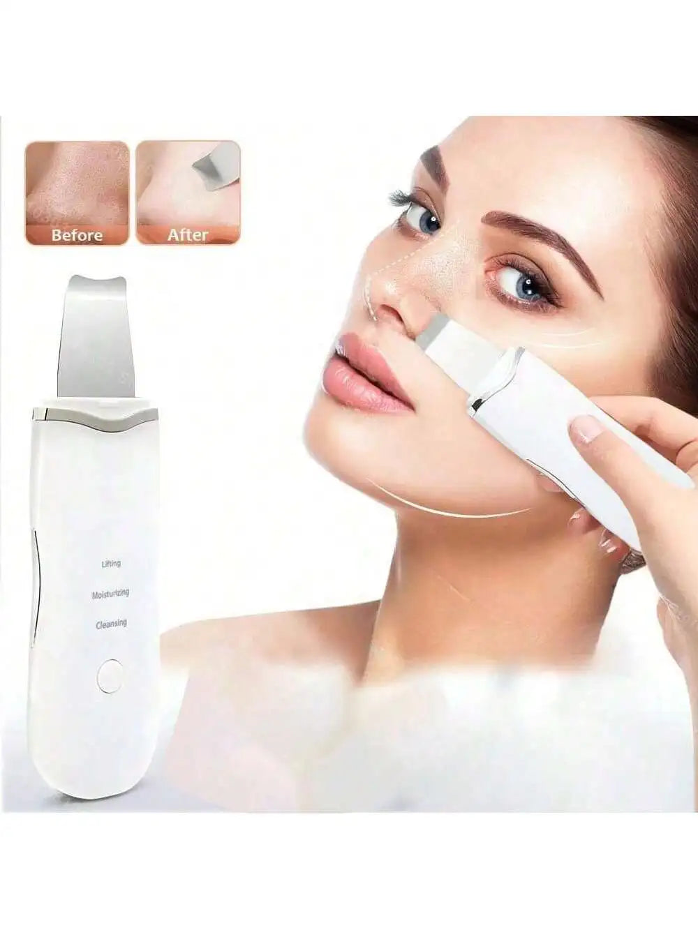 Ultrasonic Facial Skin Scrubber for Deep Pore Cleansing - 3