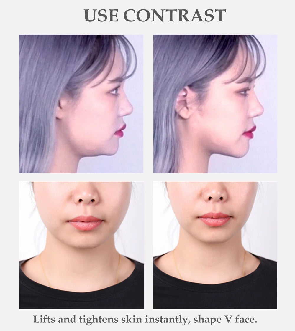 Invisible Instant Face Lifting Stickers for V-Shape Contouring - 10