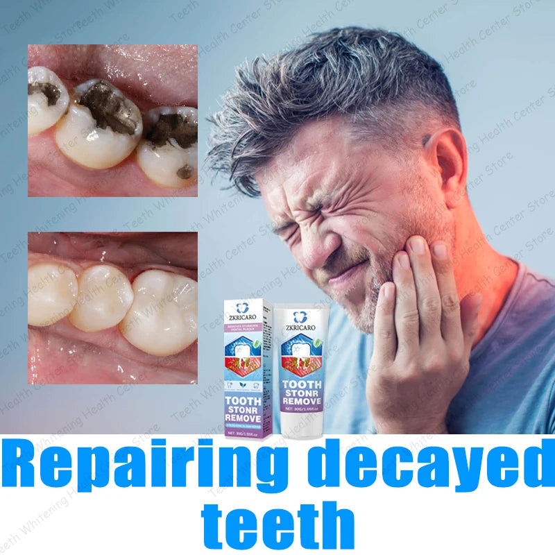 Advanced Dental Repair and Cavity Removal Treatment - 3