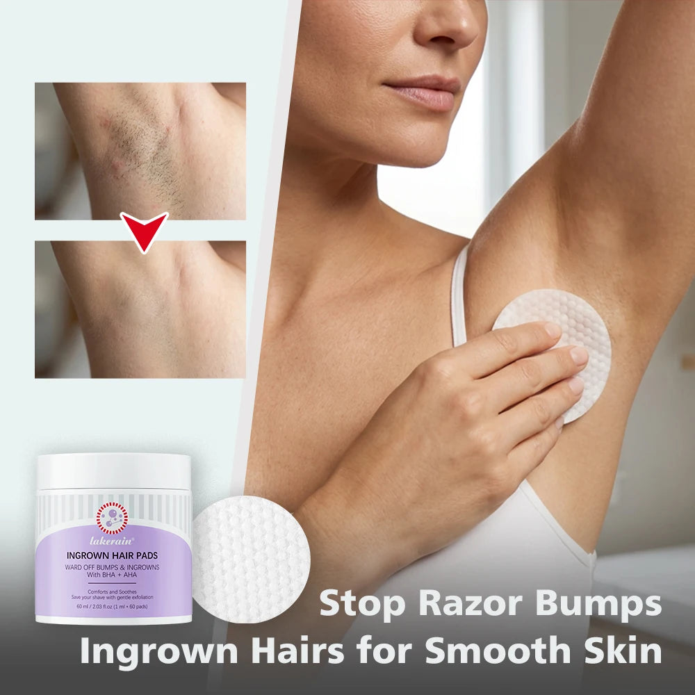 Exfoliating Ingrown Hair & Razor Bump Treatment Pads - 11