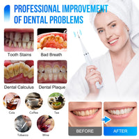 Electric Sonic Teeth Cleaner and Tartar Remover