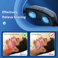 Smart Anti-Snoring Pulse Device for Restful Sleep