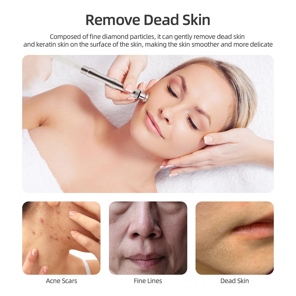 3-in-1 Professional Diamond Microdermabrasion Facial Machine - 6