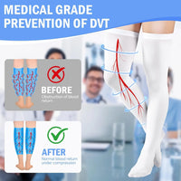 Thigh-High Graduated Compression Stockings 15-20 mmHg
