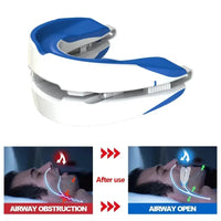 Adjustable Anti-Snoring Sleep Mouthpiece