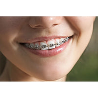 Fashionable Cosmetic Faux Braces for Parties and Cosplay