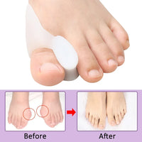 Gel Bunion Corrector and Toe Spacer for Pain Relief