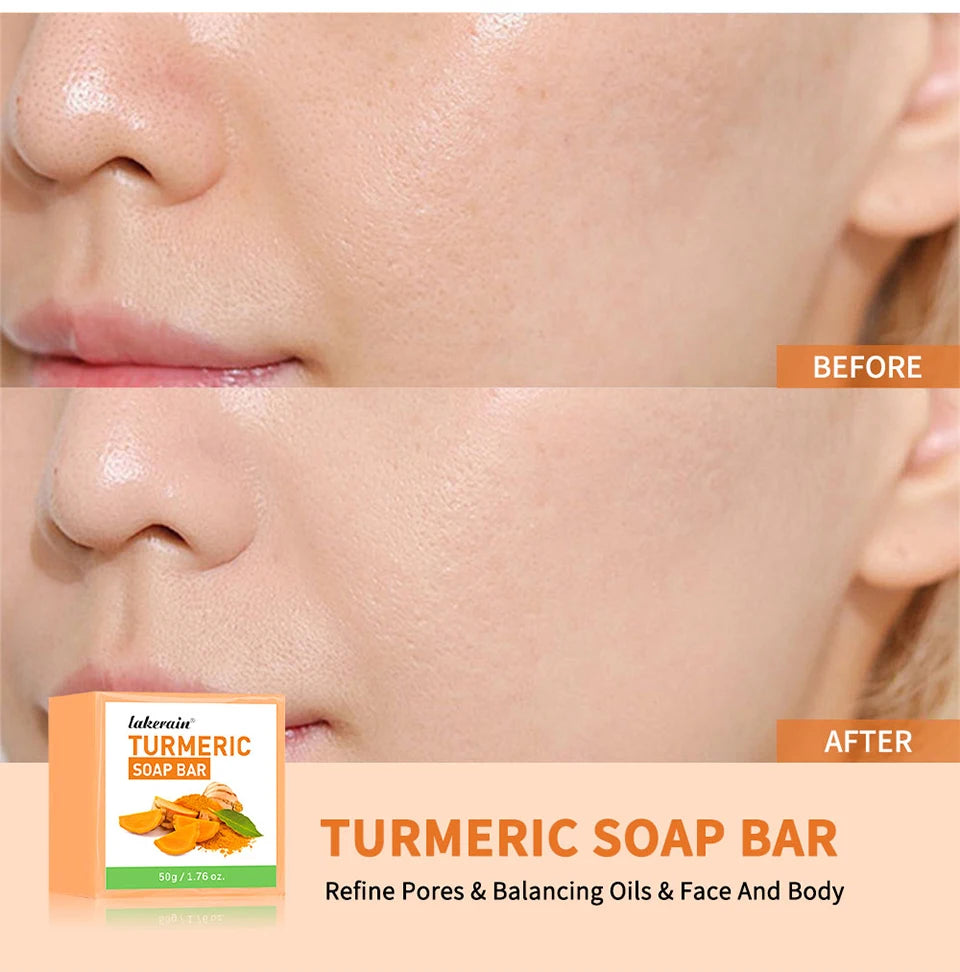 Brightening Turmeric Soap Bar for Face and Body - 9