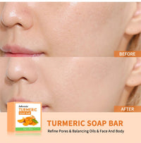 Brightening Turmeric Soap Bar for Face and Body