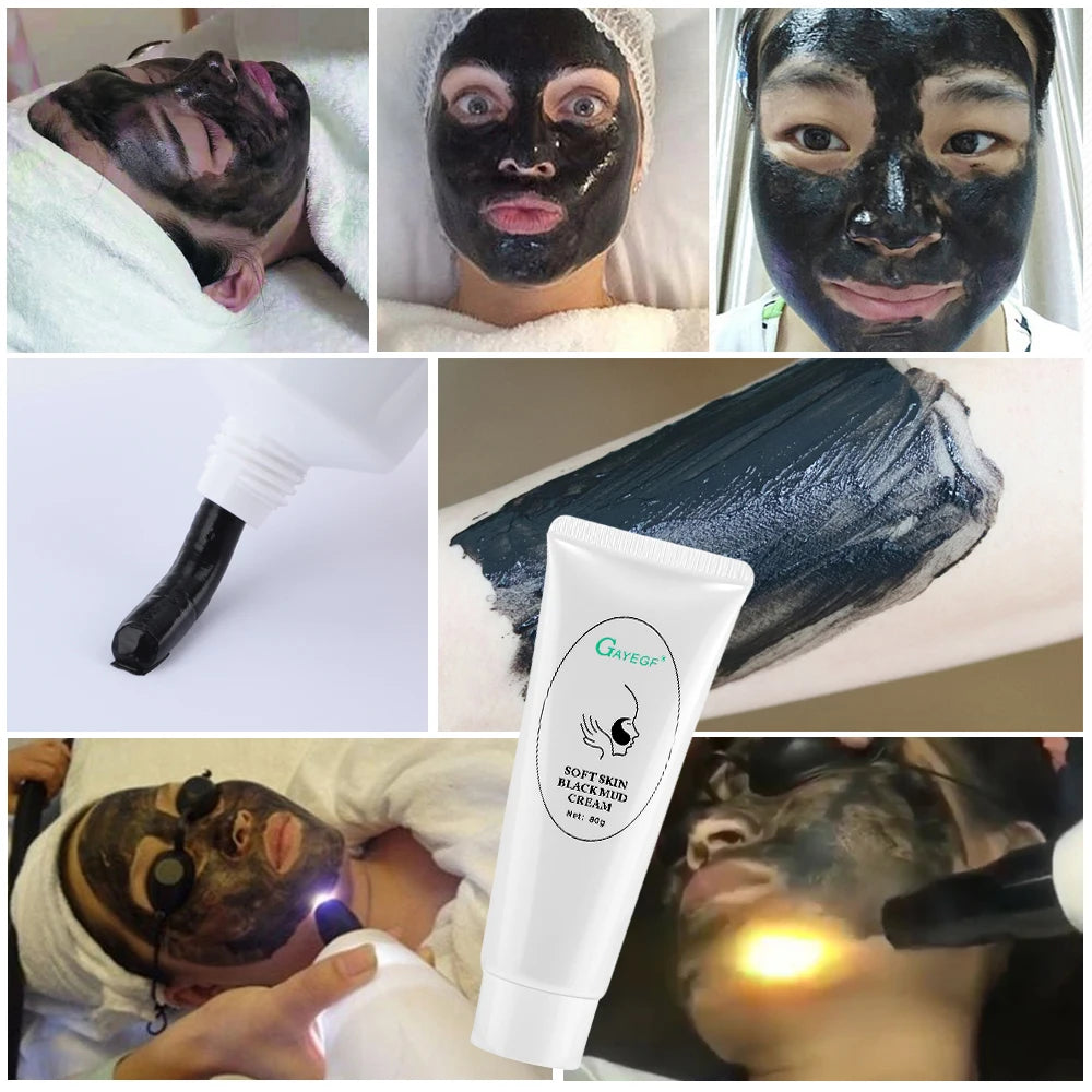 Carbon Laser Facial Resurfacing Gel for Deep Pore Cleansing - 8