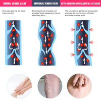 Thigh-High 20-30mmHg Compression Stockings for Leg Support
