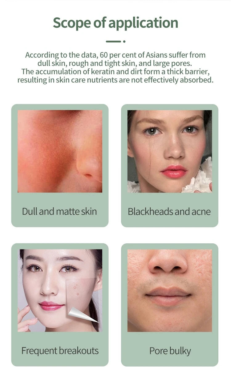 Ultrasonic Facial Skin Scrubber and Pore Cleaner - 10