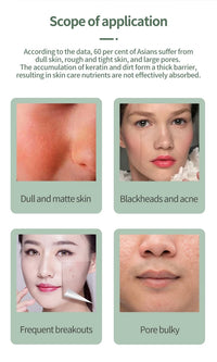 Ultrasonic Facial Skin Scrubber & Blackhead Remover