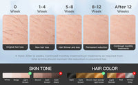 Painless IPL Hair Removal Handset with Cooling Technology